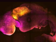 This microscope image provided by researchers Gianluca Amadei and Charlotte Handford in August 2022 shows a synthetic mouse embryo with colors added to show brain and heart formation. According to a study published in the journal Nature on Thursday, Aug. 25, scientists have created "synthetic" mouse embryos from stem cells without a dad's sperm or a mom's egg or womb.