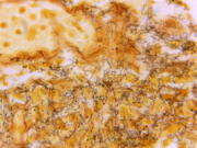 This 1966 microscope photo made available by the Centers for Disease Control and Prevention shows a tissue sample with the presence of numerous, corkscrew-shaped, darkly-stained, Treponema pallidum spirochetes, the bacterium responsible for causing syphilis. U.S. health officials on Monday, Sept. 19, 2022, are calling for a new push to prevent sexually transmitted diseases -- spurred in part by a 26 percent increase in syphilis cases last year.