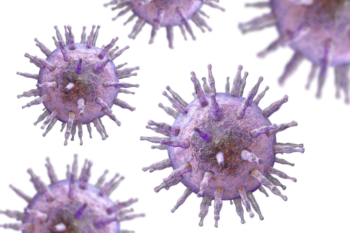 Epstein-Barr virus.