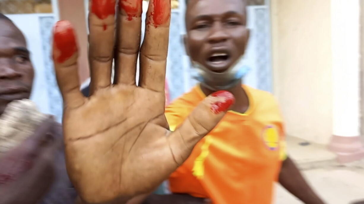 An anti-government demonstrator displays a bloody hand during clashes in N'Djamena, Chad, Thursday Oct. 20, 2022. Chadian security forces have opened fire on anti-government demonstrators in the country's two largest cities killing at least 60 people, the government spokesman and a morgue official said. Authorities imposed a curfew after Thursday's violence, which came amid protests in the central African nation against interim leader Mahamat Idriss Deby's two-year extension of power.