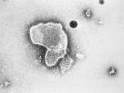 This 1981 photo provided by the Centers for Disease Control and Prevention (CDC) shows an electron micrograph of Respiratory Syncytial Virus, also known as RSV. Children's hospitals in parts of the country are seeing a distressing surge in RSV, a common respiratory illness that can cause severe breathing problems for babies. Cases fell dramatically two years ago as the pandemic shut down schools, day cares and businesses. Then, with restrictions easing, the summer of 2021 brought an alarming increase in what is normally a fall and winter virus.