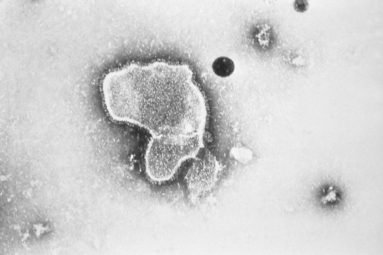 FILE - This 1981 electron microscope image provided by the Centers for Disease Control and Prevention shows a human respiratory syncytial virus, also known as RSV. On Tuesday, Feb. 28, 2023, a panel of U.S. Food and Drug Administration advisers narrowly backed an experimental vaccine from Pfizer that could become the first shot to protect older adults against the RSV respiratory virus.