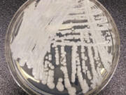 FILE - This undated photo made available by the Centers for Disease Control and Prevention shows a strain of Candida auris cultured in a petri dish at a CDC laboratory. In a CDC paper published by the Annals of Internal Medicine on Monday, March 20, 2023, U.S. cases of the dangerous fungus tripled over just three years, and more than half of states have now reported it.