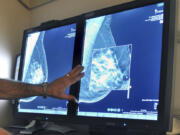 FILE - This July 31, 2012, file photo shows a mammogram, a test to detect cancer. A new study suggests that adding MRIs to mammograms to screen women with very dense breasts may find more cancers but also gives a lot of false alarms.