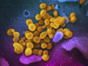 FILE - This undated, colorized electron microscope image made available by the U.S. National Institutes of Health in February 2020 shows the Novel Coronavirus SARS-CoV-2, indicated in yellow, emerging from the surface of cells, indicated in blue/pink, cultured in a laboratory. The National Institutes of Health is opening a handful of studies to start testing possible treatments for long COVID, an anxiously awaited step in U.S. efforts against the mysterious condition. The announcement, Monday, July 31, 2023 comes amid frustration from patients who've struggled for months or years with sometimes disabling health problems.