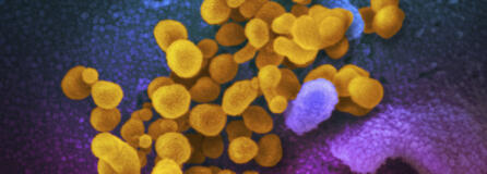 FILE - This undated, colorized electron microscope image made available by the U.S. National Institutes of Health in February 2020 shows the Novel Coronavirus SARS-CoV-2, indicated in yellow, emerging from the surface of cells, indicated in blue/pink, cultured in a laboratory. The National Institutes of Health is opening a handful of studies to start testing possible treatments for long COVID, an anxiously awaited step in U.S. efforts against the mysterious condition. The announcement, Monday, July 31, 2023 comes amid frustration from patients who've struggled for months or years with sometimes disabling health problems.