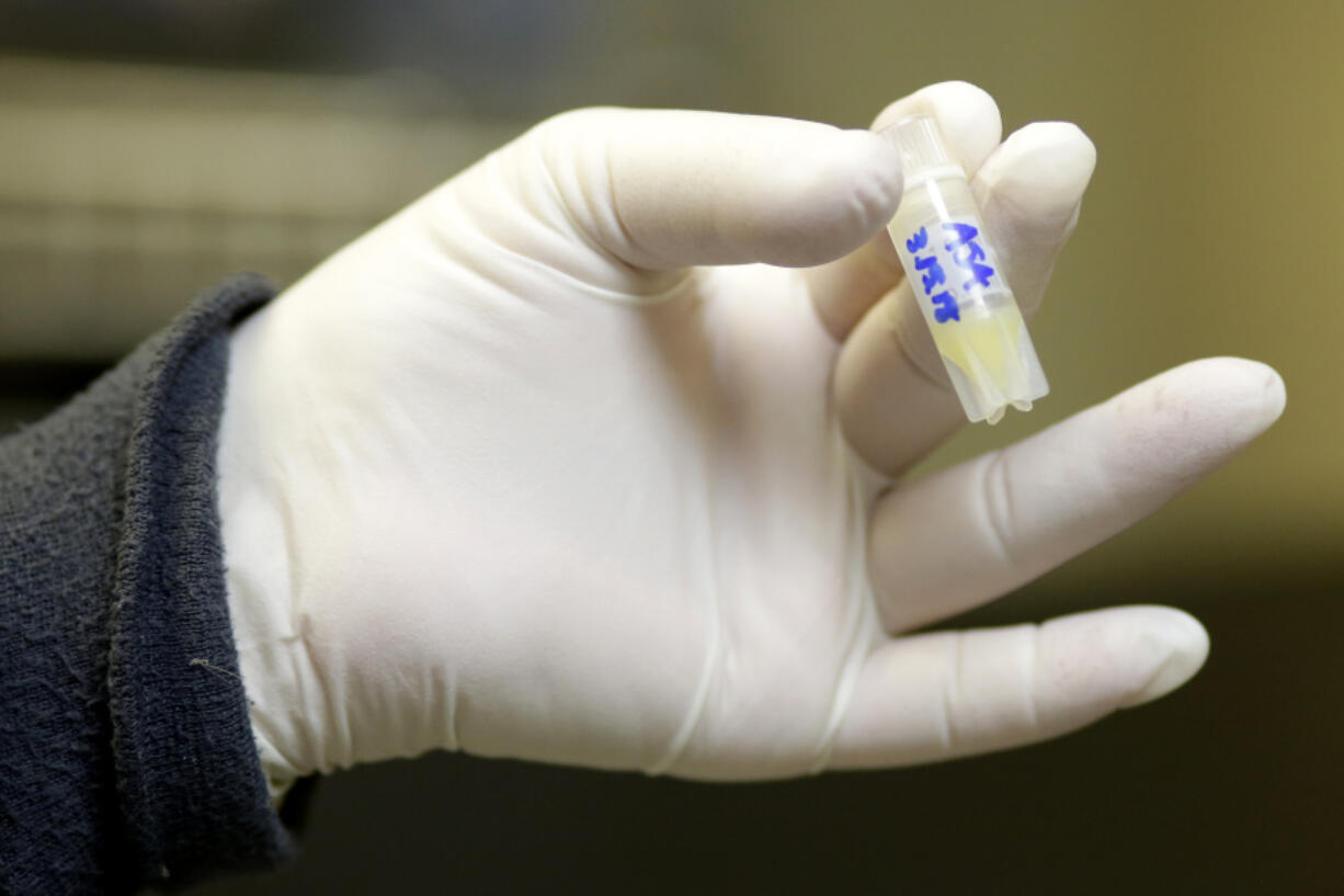 n this Tuesday, Oct. 2, 2018 photo, a lab worker holds a vial of frozen sperm at a fertility clinic in Fort Myers, Fla.