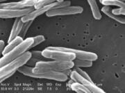 This 2006 electron microscope image provided by the Centers for Disease Control and Prevention shows Mycobacterium tuberculosis bacteria, which causes the disease tuberculosis. The number of U.S. tuberculosis cases in 2023 was the highest in a decade, according to a report released by the CDC on Thursday, March 28, 2024.