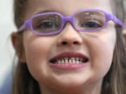 Amber Warner shows off her teeth after a dental exam at the Christa McAuliffe School in Concord, N.H., Wednesday, Feb. 21, 2024. The federal government and the dental community are increasing efforts to reach children at an early age. (AP Photo/Robert F.