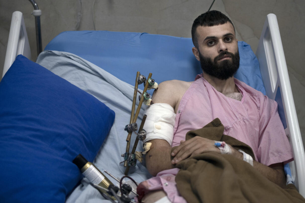 Mujahid Abadi, 24, poses for a portrait Tuesday at the Ibn Sina Specialized Hospital in the West Bank city of Jenin, where he is recovering from gunshot wounds and burns.