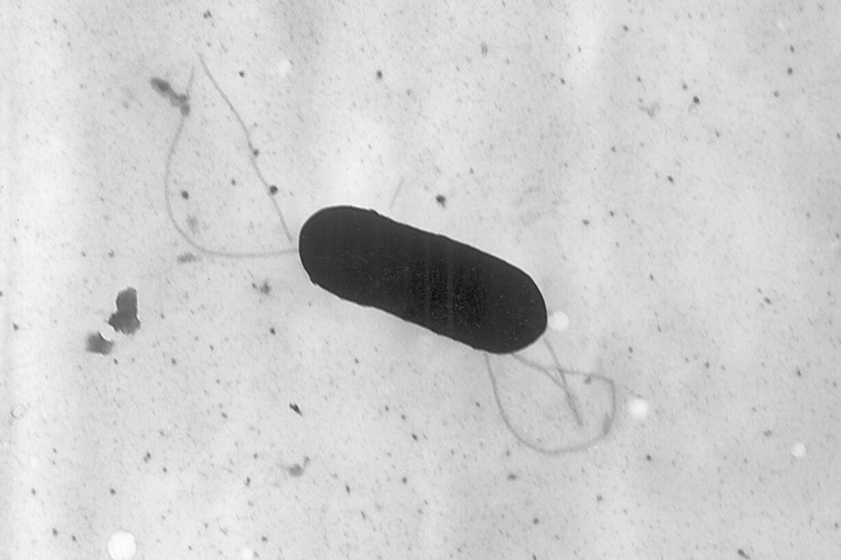 FILE - This 2002 electron microscope image made available by the Centers for Disease Control and Prevention shows a Listeria monocytogenes bacterium.  Health officials have announced a recall of liverwurst and deli meat products, Friday, July 26, 2024, in connection with a national listeria outbreak that has sickened nearly three dozen people in 13 states.