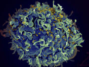 FILE - This electron microscope image made available by the U.S. National Institutes of Health shows a human T cell, in blue, under attack by HIV, in yellow, the virus that causes AIDS.