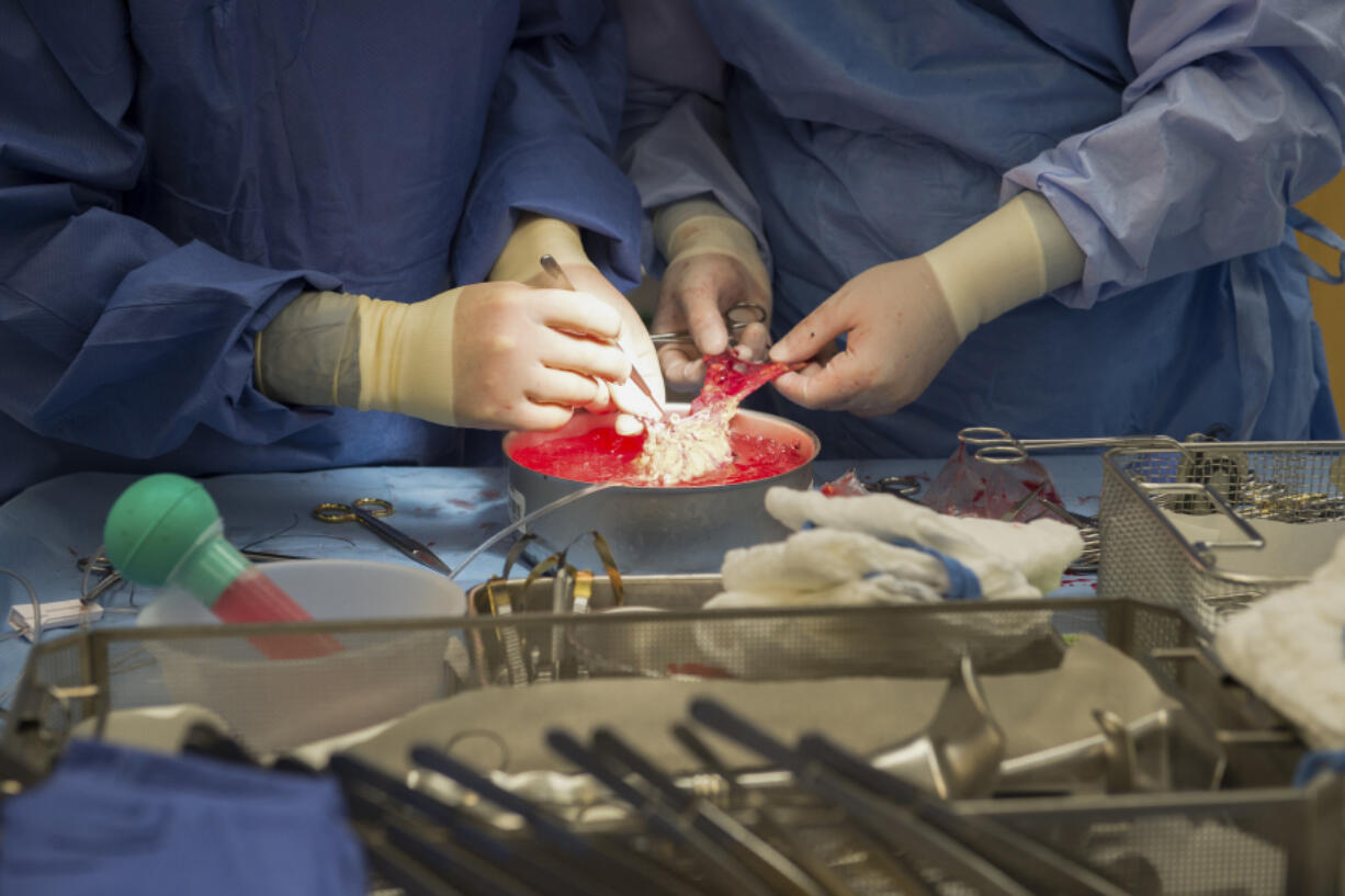 FILE - Surgeons work on a kidney during a transplant surgical procedure in Washington on June 28, 2016.