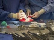 FILE - Surgeons work on a kidney during a transplant surgical procedure in Washington on June 28, 2016.