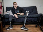 Derrik lost both his legs in June 2023, the summer after his sophomore year of high school, while working for a large construction company in southwestern Washington as part of a school program that allowed him to earn class credit for hours on the job.