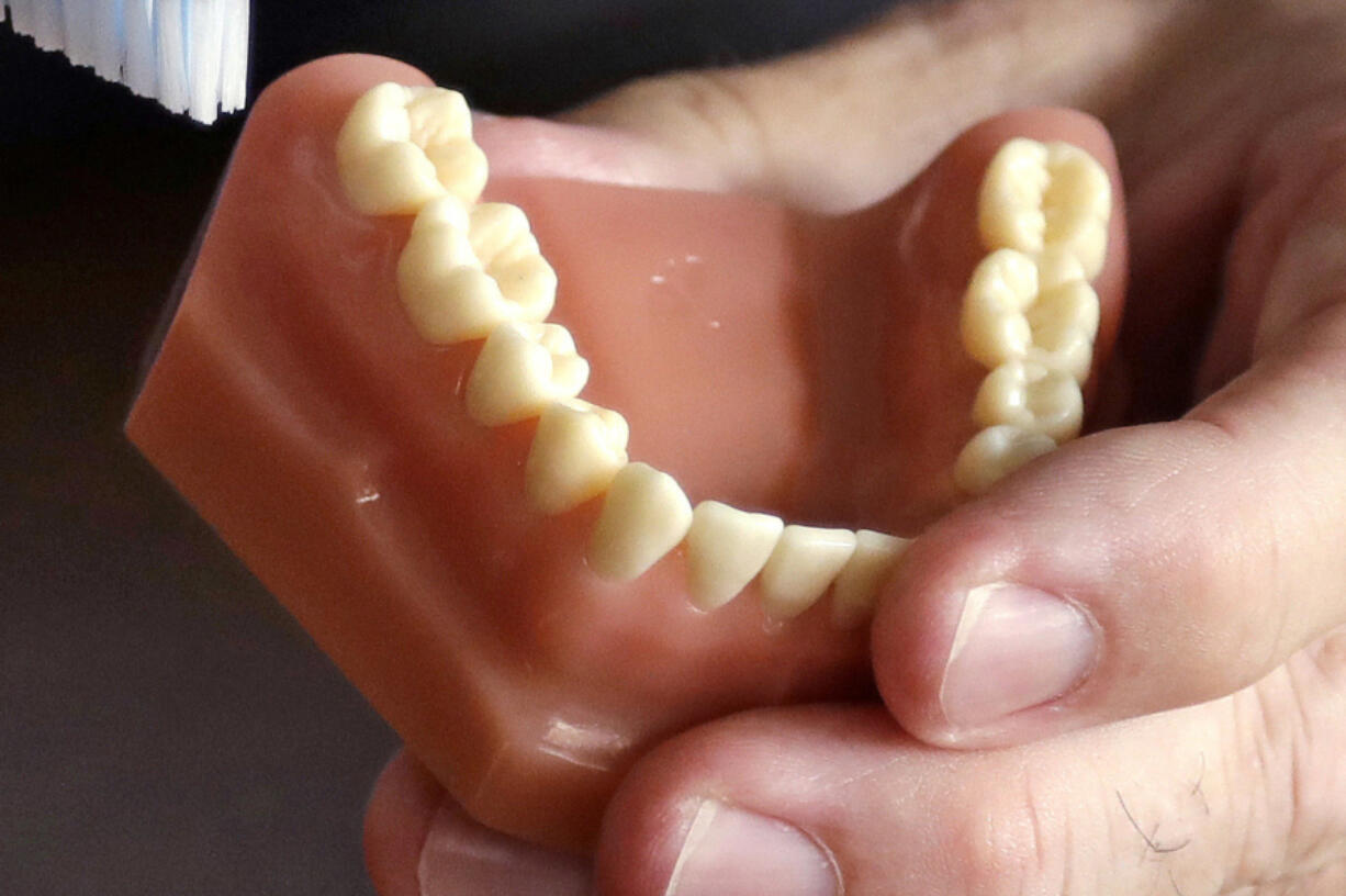 FILE - A dentist holds a model of teeth in Seattle.