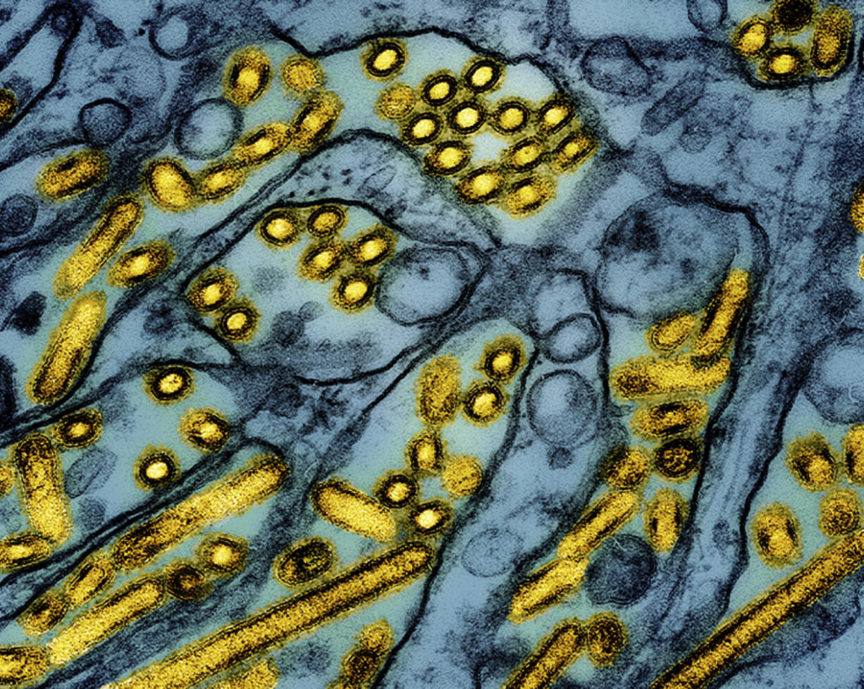 This colorized electron microscope image released by the National Institute of Allergy and Infectious Diseases on March 26, 2024, shows avian influenza A H5N1 virus particles (yellow), grown in Madin-Darby Canine Kidney (MDCK) epithelial cells (blue).