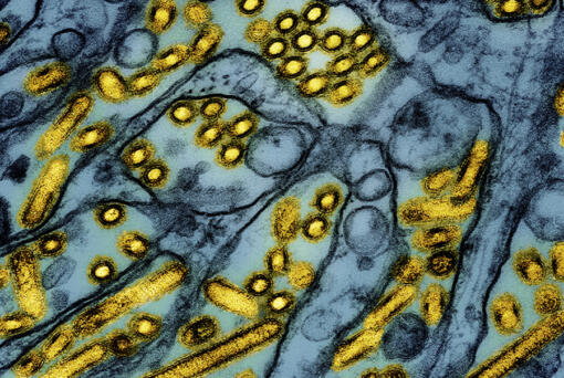 This colorized electron microscope image released by the National Institute of Allergy and Infectious Diseases on March 26, 2024, shows avian influenza A H5N1 virus particles (yellow), grown in Madin-Darby Canine Kidney (MDCK) epithelial cells (blue).