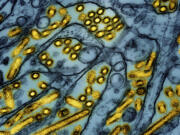 This colorized electron microscope image released by the National Institute of Allergy and Infectious Diseases on March 26, 2024, shows avian influenza A H5N1 virus particles (yellow), grown in Madin-Darby Canine Kidney (MDCK) epithelial cells (blue).