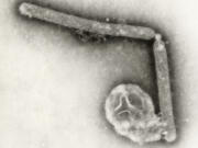 This undated electron microscopic image provided by the Centers for Disease Control and Prevention shows two Influenza A (H5N1) virions, a type of bird flu virus.