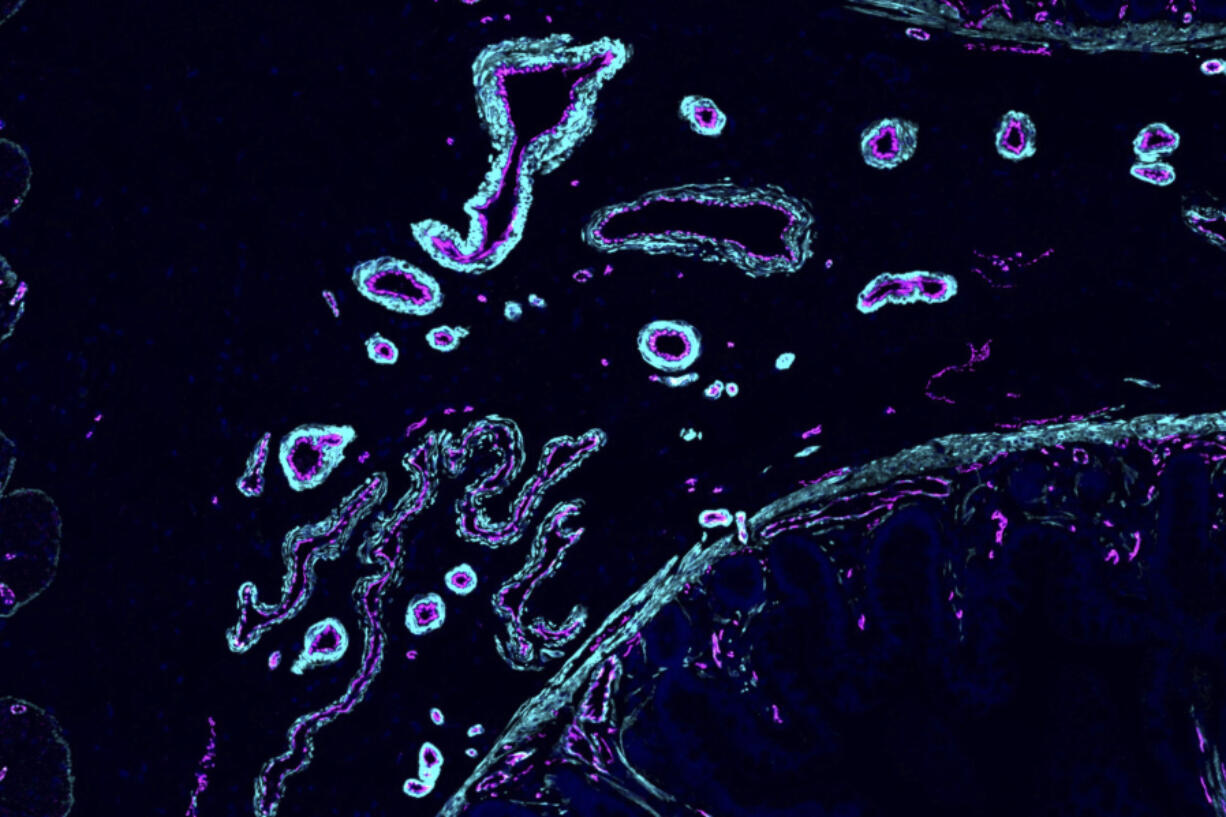 Blood vessels in a portion of the human small intestine.